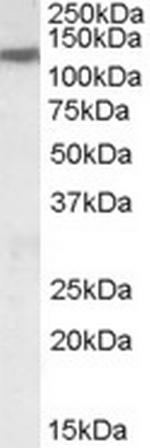 KCC3 Antibody in Western Blot (WB)