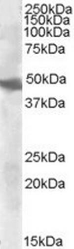 GOT2 Antibody in Western Blot (WB)