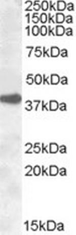 ERCC1 Antibody in Western Blot (WB)