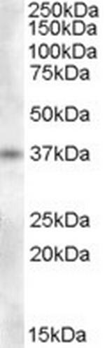 PENK Antibody in Western Blot (WB)