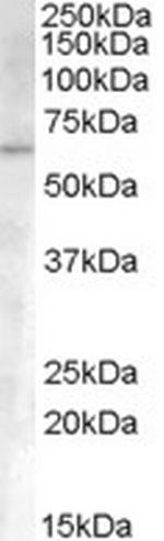 ACVR1 Antibody in Western Blot (WB)