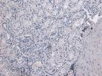 TMPRSS2 Antibody in Immunohistochemistry (Paraffin) (IHC (P))