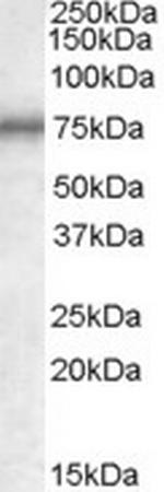 MEPCE Antibody in Western Blot (WB)