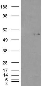 GCNT3 Antibody in Western Blot (WB)