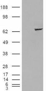 IGF2BP2 Antibody in Western Blot (WB)