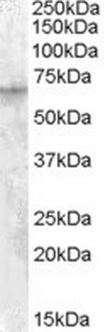 IGF2BP2 Antibody in Western Blot (WB)