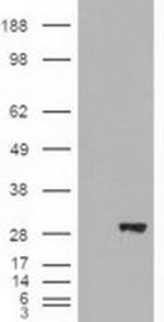 BDH2 Antibody in Western Blot (WB)