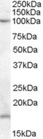 TEB4 Antibody in Western Blot (WB)