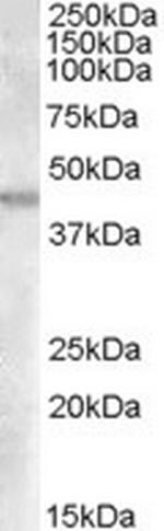 GOT2 Antibody in Western Blot (WB)