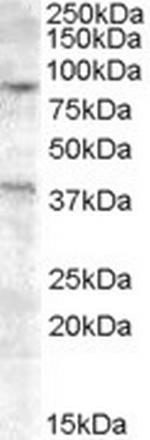 EXO1 Antibody in Western Blot (WB)