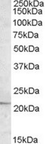 APOBEC3C Antibody in Western Blot (WB)