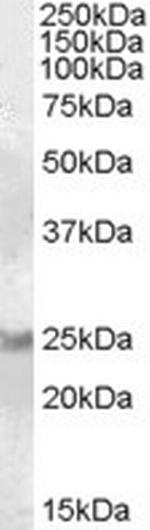 RAB8A Antibody in Western Blot (WB)