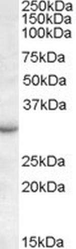 RAB23 Antibody in Western Blot (WB)