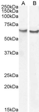 Frizzled-2 Antibody in Western Blot (WB)