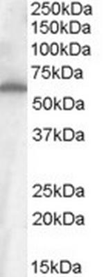 FZD4 Antibody in Western Blot (WB)