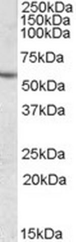 CES1 Antibody in Western Blot (WB)