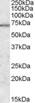 MARK2 Antibody in Western Blot (WB)