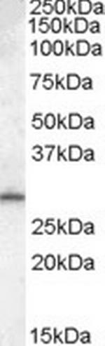 MTHFD2L Antibody in Western Blot (WB)