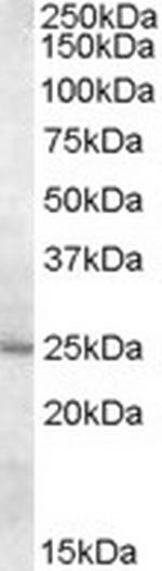 MTHFS Antibody in Western Blot (WB)