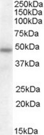 SERPINA12 Antibody in Western Blot (WB)