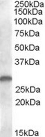 CLEC1B Antibody in Western Blot (WB)