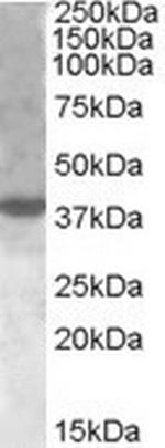 XBP1 Antibody in Western Blot (WB)