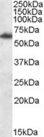 FTO Antibody in Western Blot (WB)