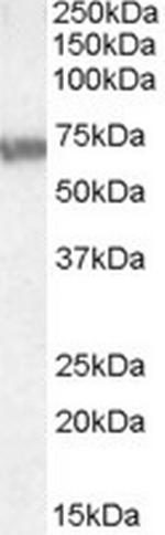 ABCD4 Antibody in Western Blot (WB)