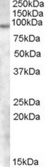 TCHHL1 Antibody in Western Blot (WB)