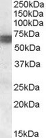 BIN1 Antibody in Western Blot (WB)