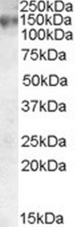 MRP1 Antibody in Western Blot (WB)