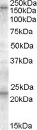 SUR1 Antibody in Western Blot (WB)