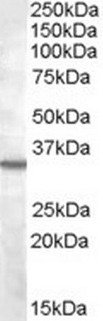 B1 Bradykinin Receptor Antibody in Western Blot (WB)