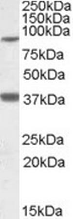 Lass1 Antibody in Western Blot (WB)