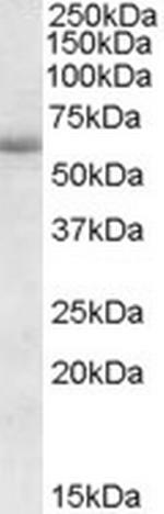 CDH23 Antibody in Western Blot (WB)