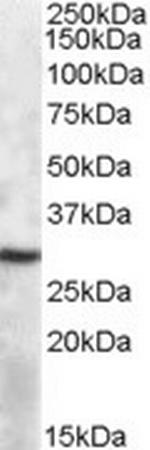 APOBEC1 Antibody in Western Blot (WB)