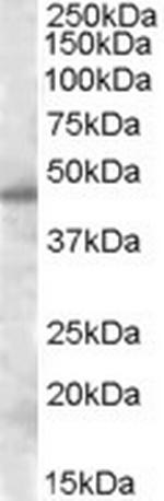 Septin-7 Antibody in Western Blot (WB)