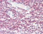 DPM1 Antibody in Immunohistochemistry (Paraffin) (IHC (P))