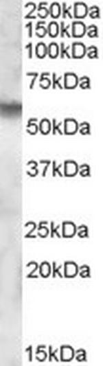 Iduronate 2 Sulfatase Antibody in Western Blot (WB)