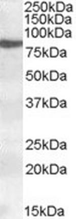 ALOX15 Antibody in Western Blot (WB)