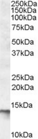 C1D Antibody in Western Blot (WB)