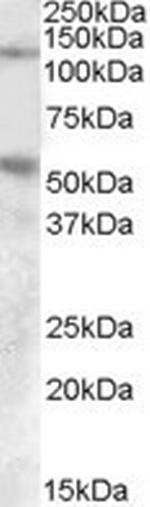 Palladin Antibody in Western Blot (WB)