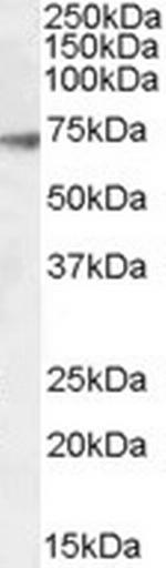 GABRA4 Antibody in Western Blot (WB)