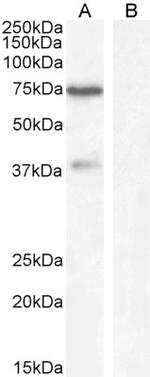 WIZ Antibody in Western Blot (WB)