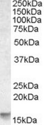 NOXA Antibody in Western Blot (WB)