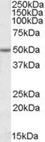 EVL Antibody in Western Blot (WB)