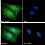 S100A9 Antibody in Immunocytochemistry (ICC/IF)