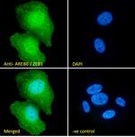 ZEB1 Antibody in Immunocytochemistry (ICC/IF)