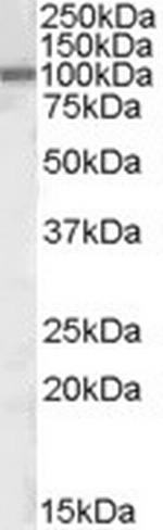 ZEB1 Antibody in Western Blot (WB)