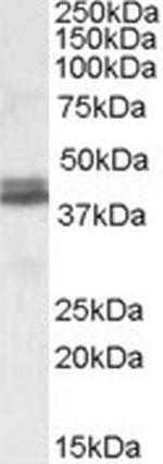 Nudel Antibody in Western Blot (WB)